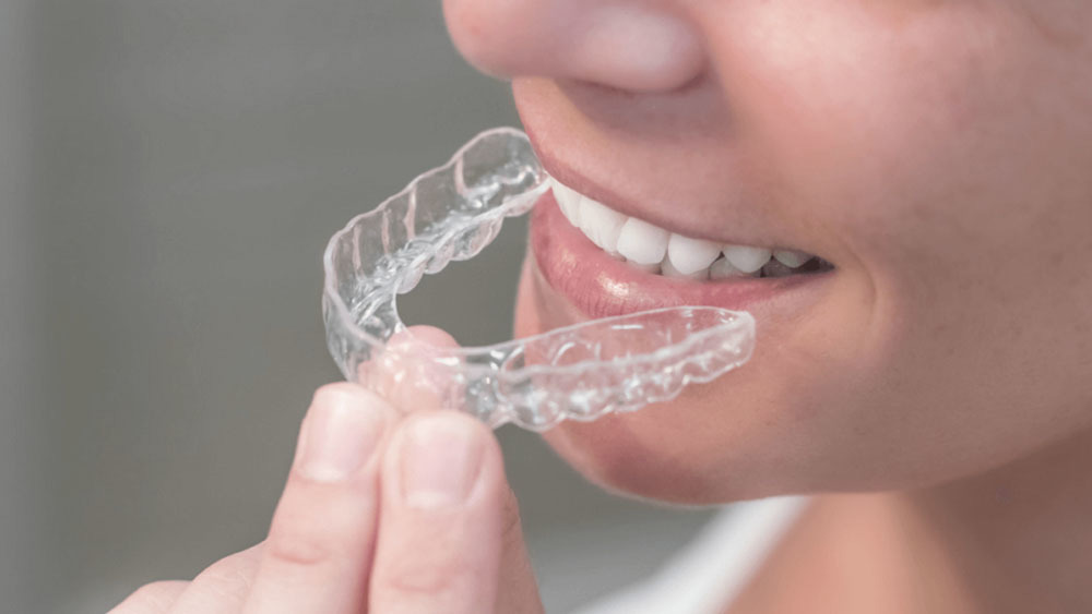 Non-Invasive Cosmetic Dental Procedures