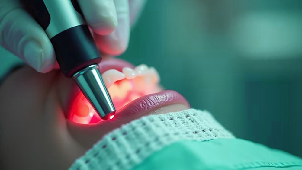 The Benefits of Laser Dentistry: A Modern Approach