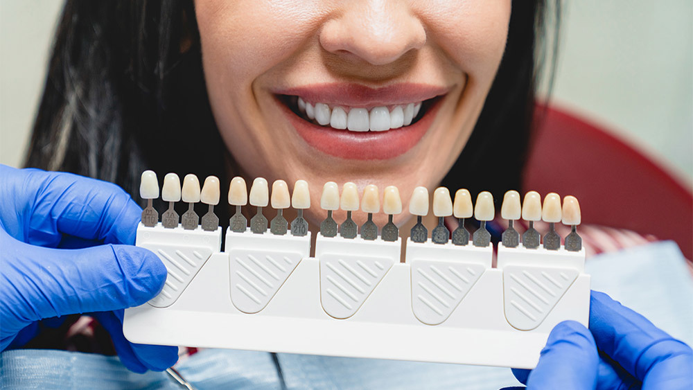 Laminate Veneers Or Zirconium Crowns? Which One is Better?