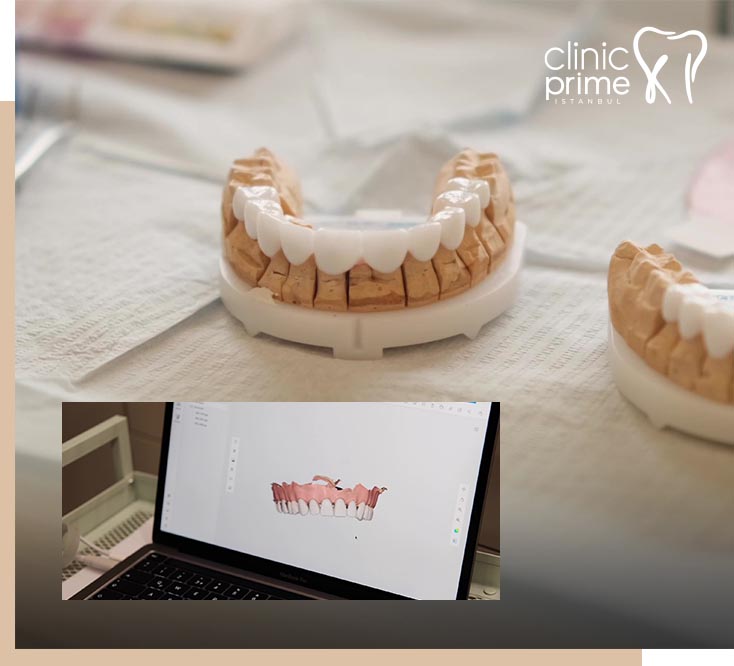 Zirconium Crown Treatment in Istanbul