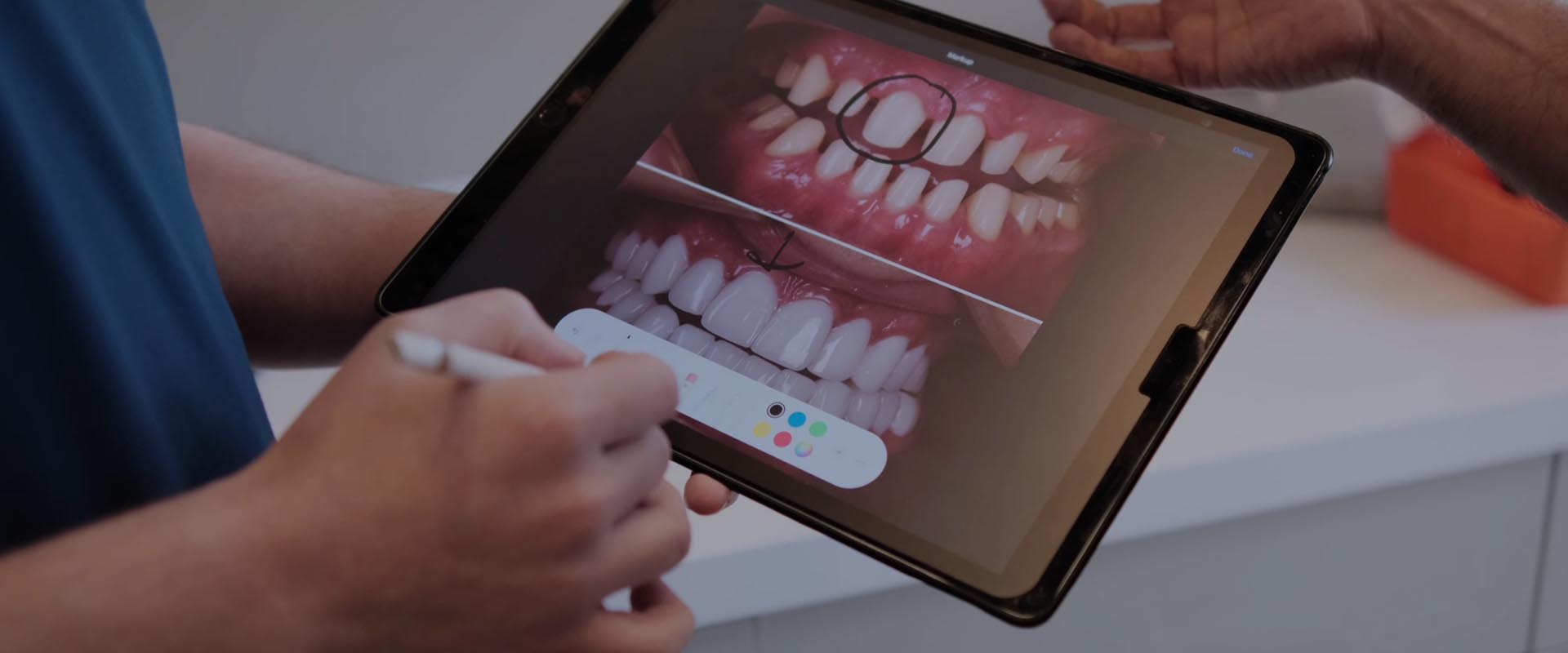 Smile Design